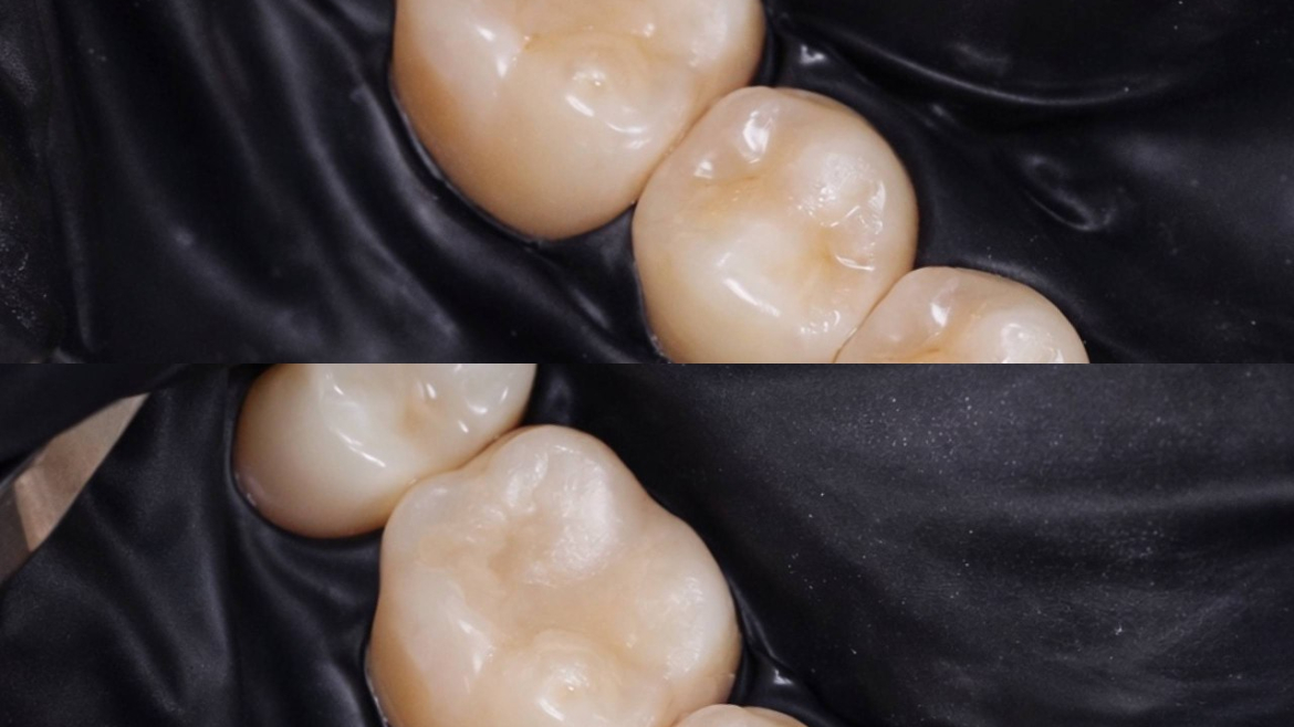 Робота нашого лікаря-терапевта ОКСАНИ ВІКТОРІВНИ