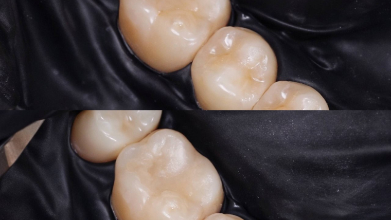 Робота нашого лікаря-терапевта ОКСАНИ ВІКТОРІВНИ