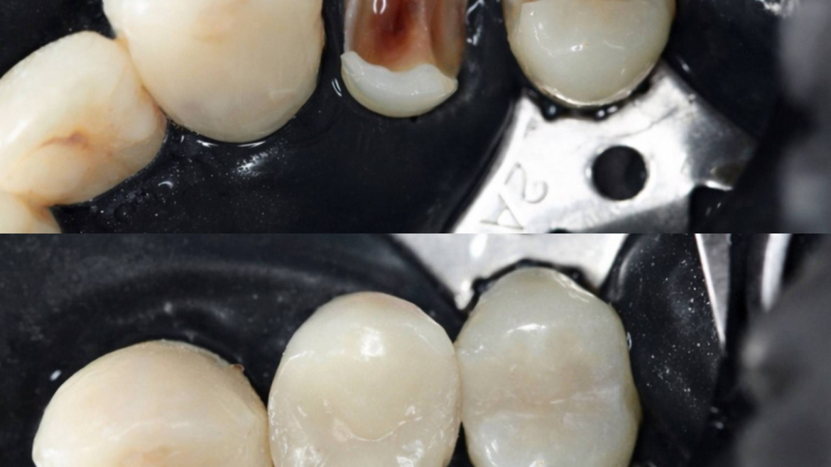 Робота нашого лікаря-терапевта КАТЕРИНИ ДМИТРІВНИ